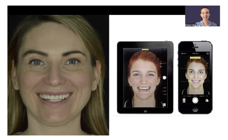 Facial and intraoral capture on tablet and phone, in the operatory